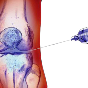 terapia infaltritiva biologica dottor paolo dolci
